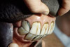 Horse Teeth